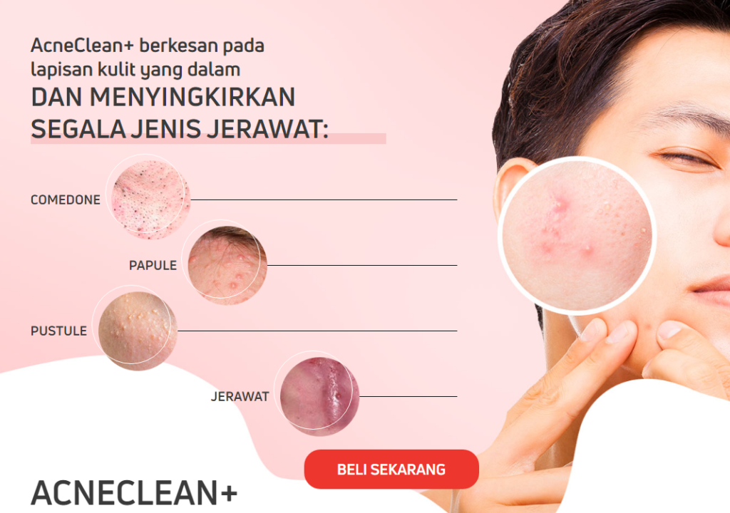 AcneClean harga